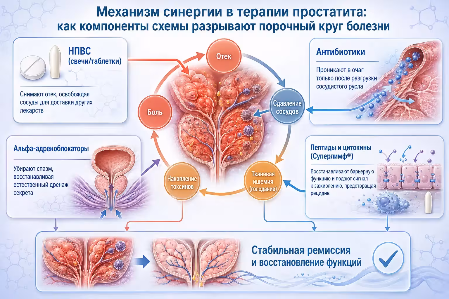 Инфографика механизма комплексного лечения простатита и синергии лекарственных препаратов.