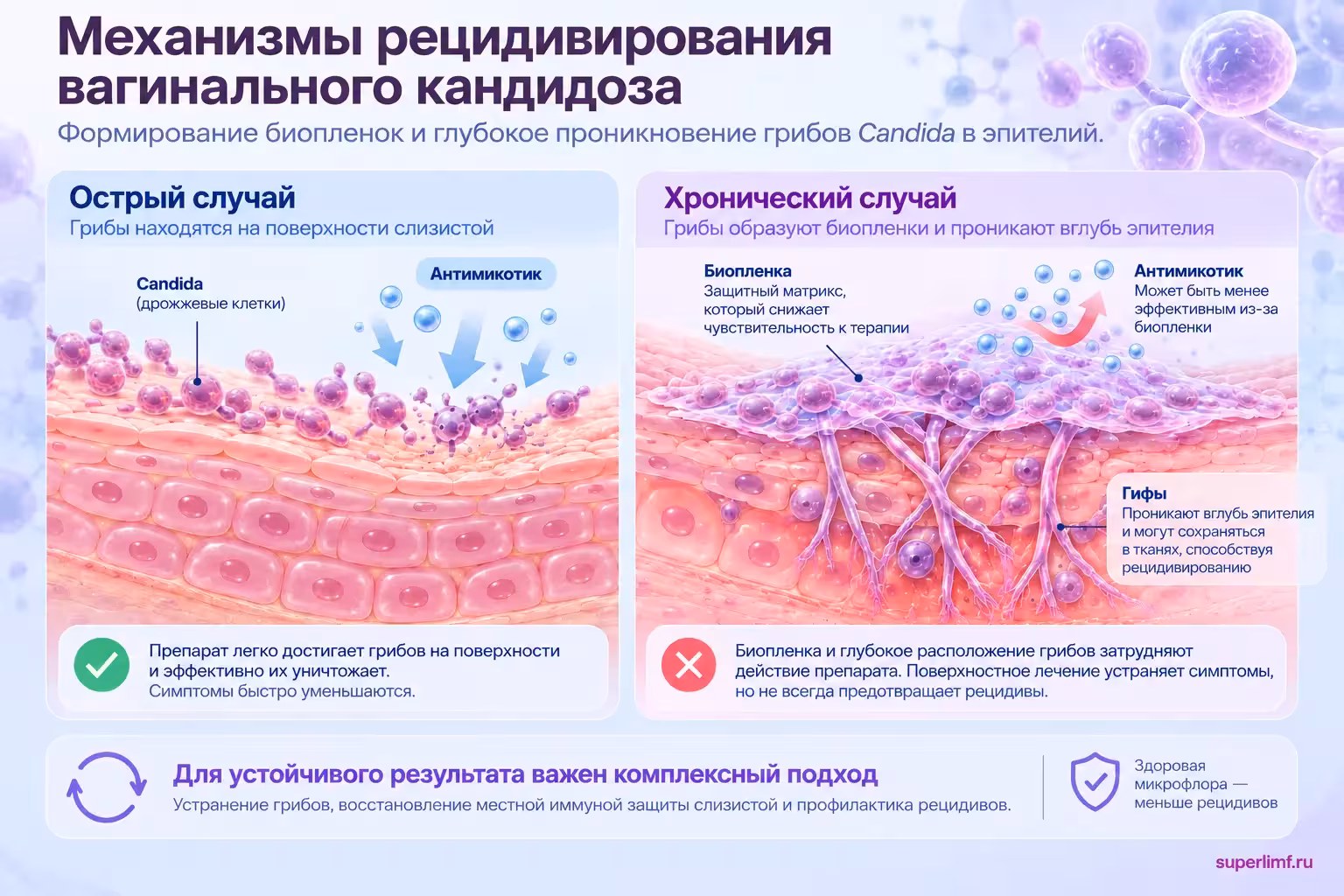 Инфографика «Механизмы рецидивирования вагинального кандидоза»