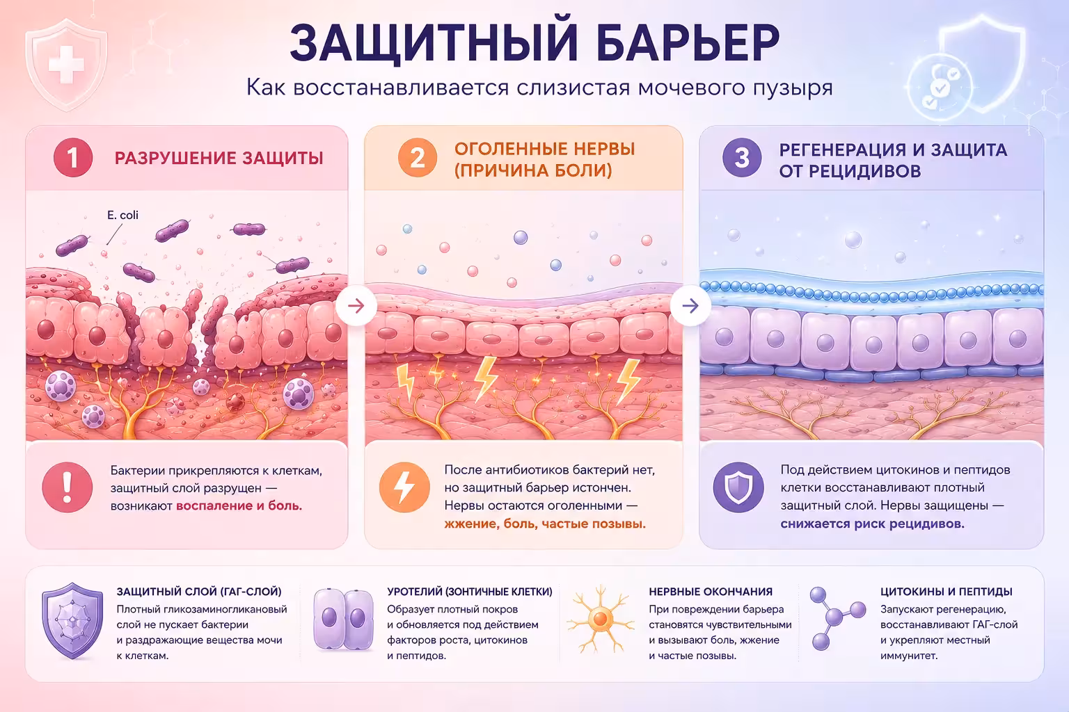 Схема восстановления уротелия и защитного гликозаминогликанового слоя при лечении цистита у женщин